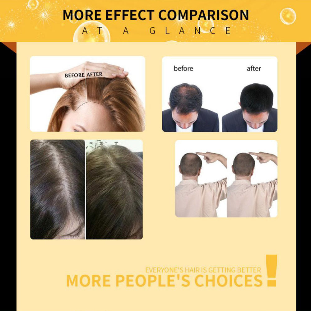 Damaged Hair Repair Women Men's Fast Hair Growth Essence Oil Anti-hair Loss Lotion Damaged Hair Repair Women Men's Fast Hair Growth Essence Oil Anti-hair Loss Lotion